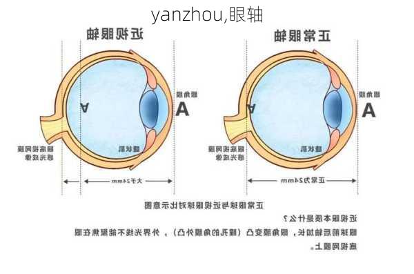 yanzhou,眼轴-第1张图片-阳光出游网